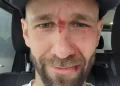 Pius Paschke je doživio pad na treningu u Innsbrucku.