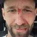 Pius Paschke je doživio pad na treningu u Innsbrucku.